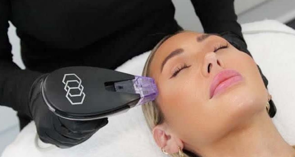 Morpheus8 Hadirkan Teknologi Perawatan Kulit Artis Hollywood