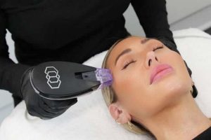 Morpheus8 Hadirkan Teknologi Perawatan Kulit Artis Hollywood